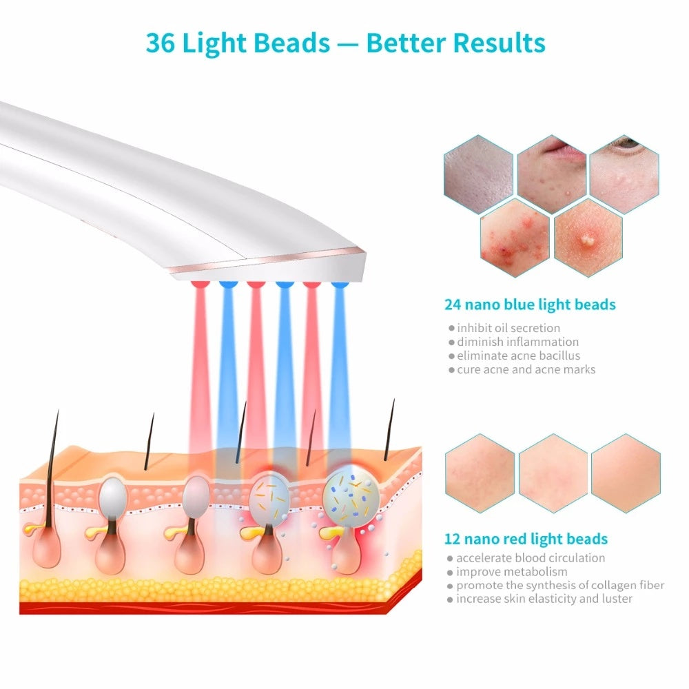 Acne Light Therapy