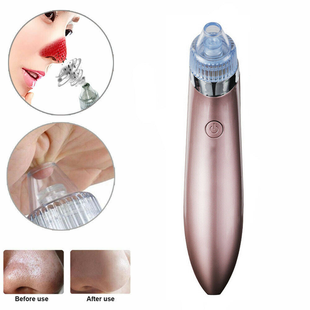 Blackhead Remover Vacuum