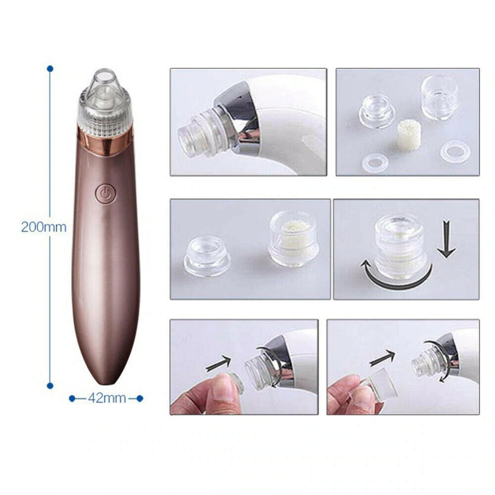 Blackhead Remover Vacuum