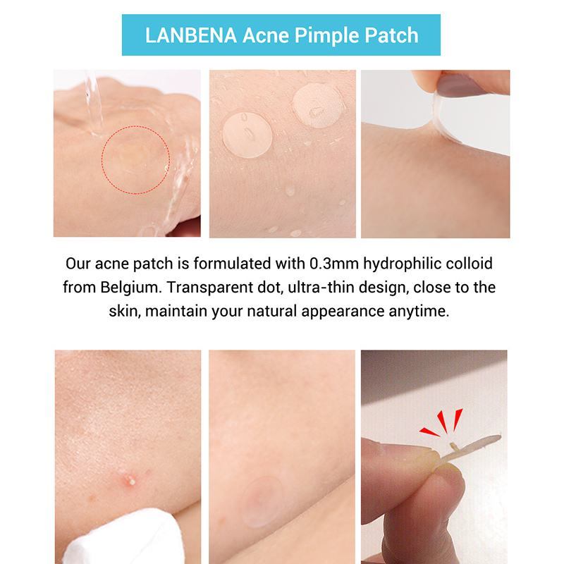 Acne Patches