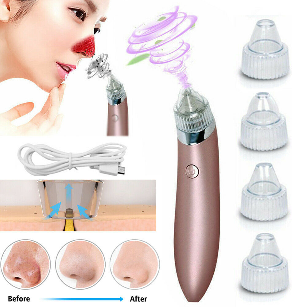 Blackhead Remover Vacuum